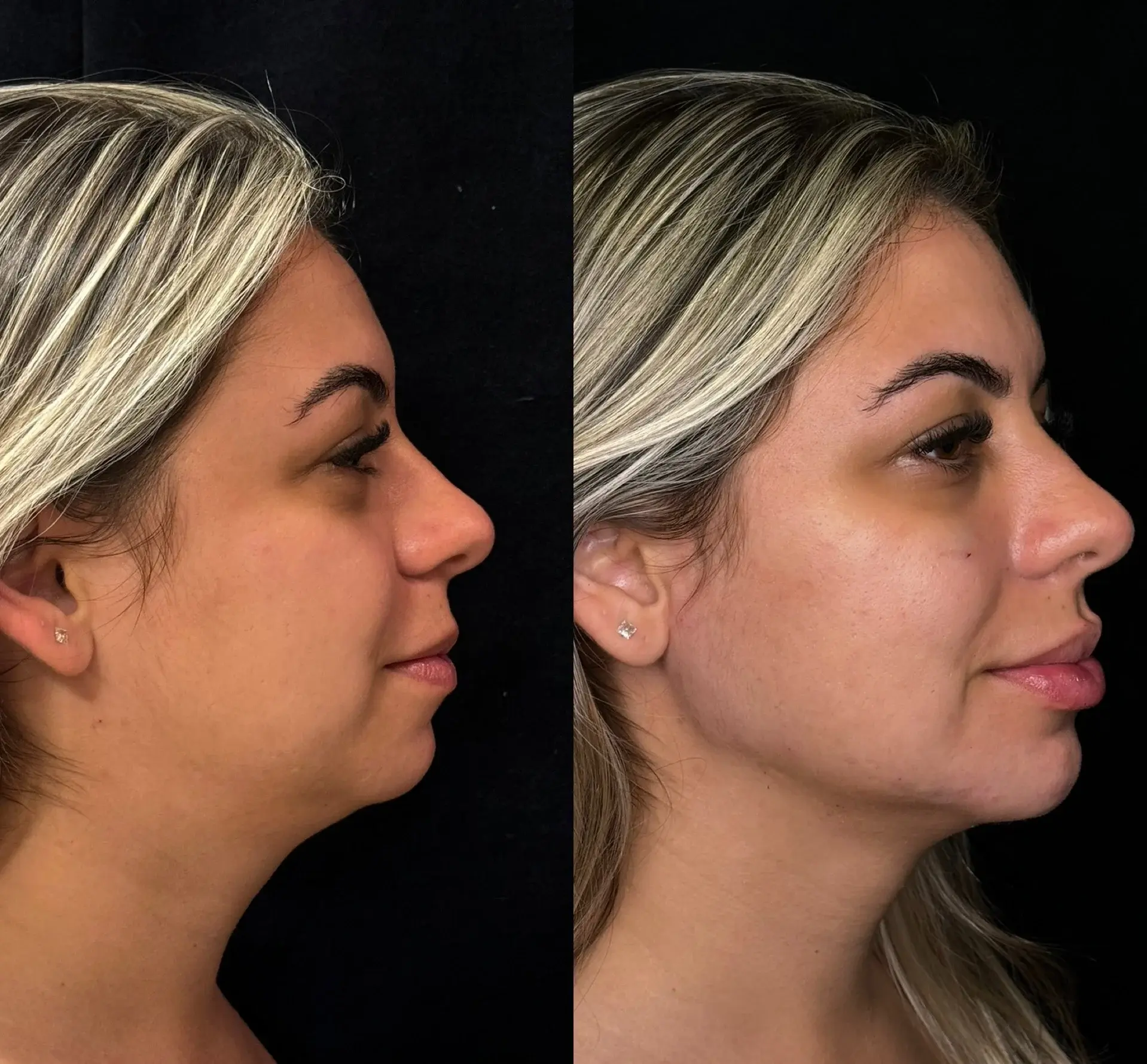 Resultado de Full Face